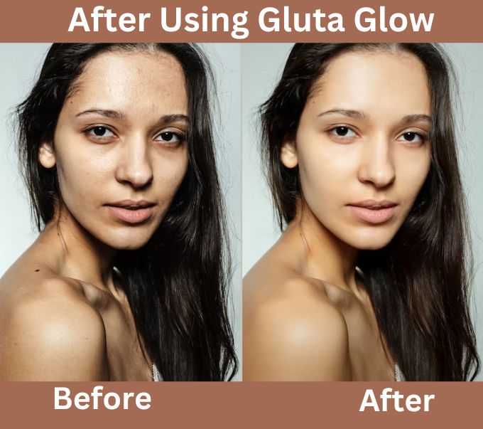 Before After